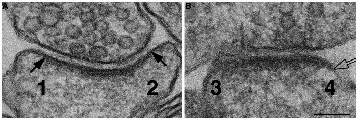 Modification of the synaptic cleft under excitatory conditions.