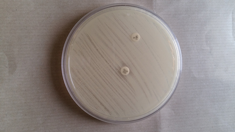 Comparison of Disk Diffusion and Agar Dilution Method for the Detection of Mupirocin Resistance in Staphylococcal Isolates from Skin and Soft Tissue Infections.