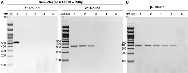 First report of putative Leishmania RNA virus 2 (LRV2) in Leishmania infantum strains from canine and human visceral leishmaniasis cases in the southeast of Brazil.