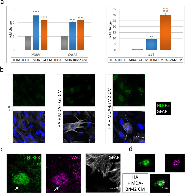 Inflammasome activation in peritumoral astrocytes is a key player in breast cancer brain metastasis development.