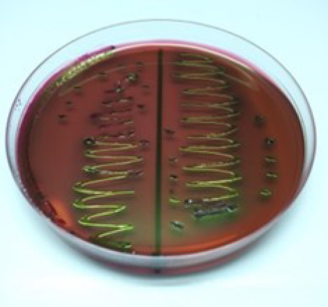 Molecular identification of <i>bla</i>TEM and <i>bla</i>CTX-M genes in multidrug-resistant <i>Escherichia coli</i> found in milk samples from dairy cattle farms in Tulungagung, Indonesia.