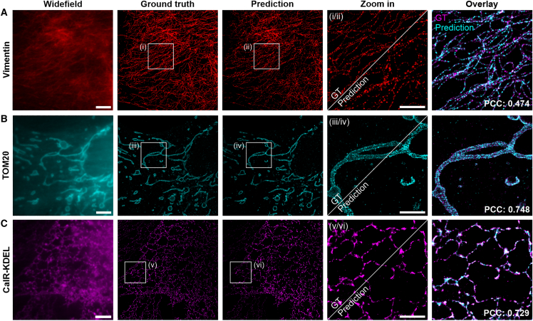 Neural network-assisted single-molecule localization microscopy with a weak-affinity protein tag.