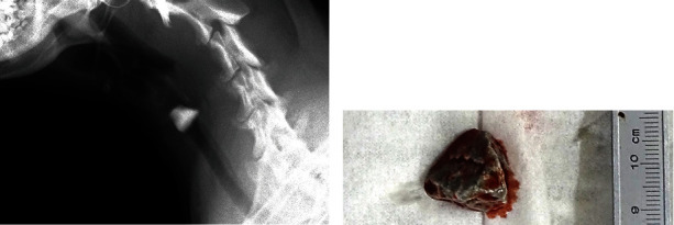 Emergency Removal of a Proximal Tracheal Foreign Body by Tracheotomy in a Dog and a Cat.