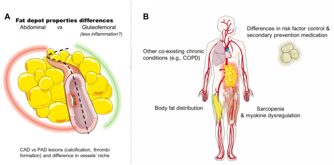 Obesity and Peripheral Artery Disease: Current Evidence and Controversies.