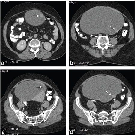 What is your diagnosis?