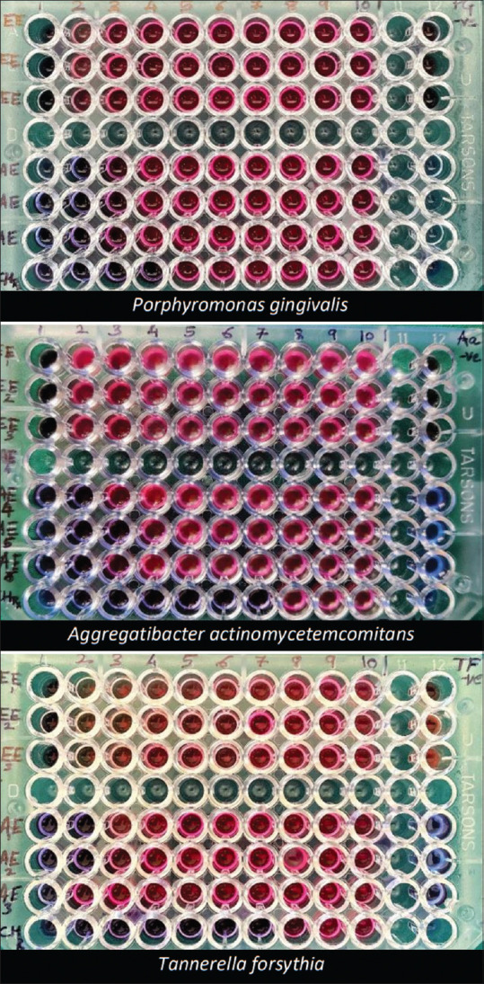 Assessment of potential antimicrobial activity of <i>Ocimum basilicum</i> extract and chlorhexidine against Socransky's complex pathogens of oral cavity: An <i>in vitro</i> study.