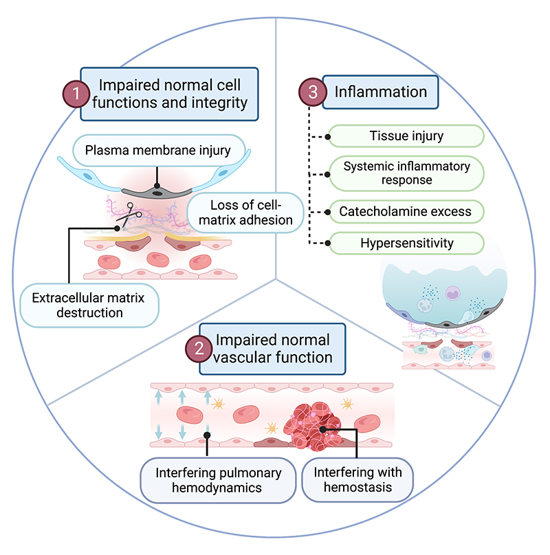 Pulmonary involvement from animal toxins: the cellular mechanisms.