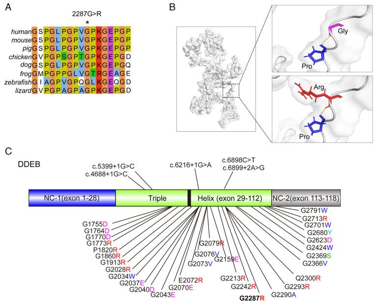 Genetic diagnosis of a rare COL7A1 variant causing dystrophic epidermolysis bullosa pruriginosa through whole‑exome sequencing.