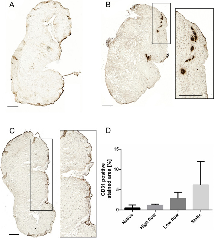 Challenges of aortic valve tissue culture - maintenance of viability and extracellular matrix in the pulsatile dynamic microphysiological system.