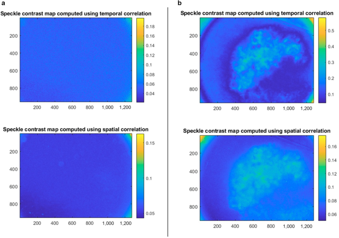 Applications of Laser Speckle Contrast Imaging Technology in Dermatology