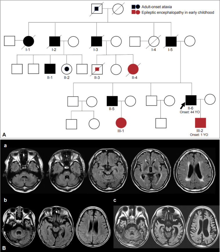 Nine Hereditary Movement Disorders First Described in Asia: Their History and Evolution.