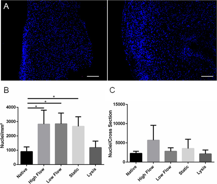 Challenges of aortic valve tissue culture - maintenance of viability and extracellular matrix in the pulsatile dynamic microphysiological system.