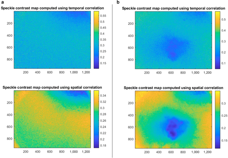 Applications of Laser Speckle Contrast Imaging Technology in Dermatology