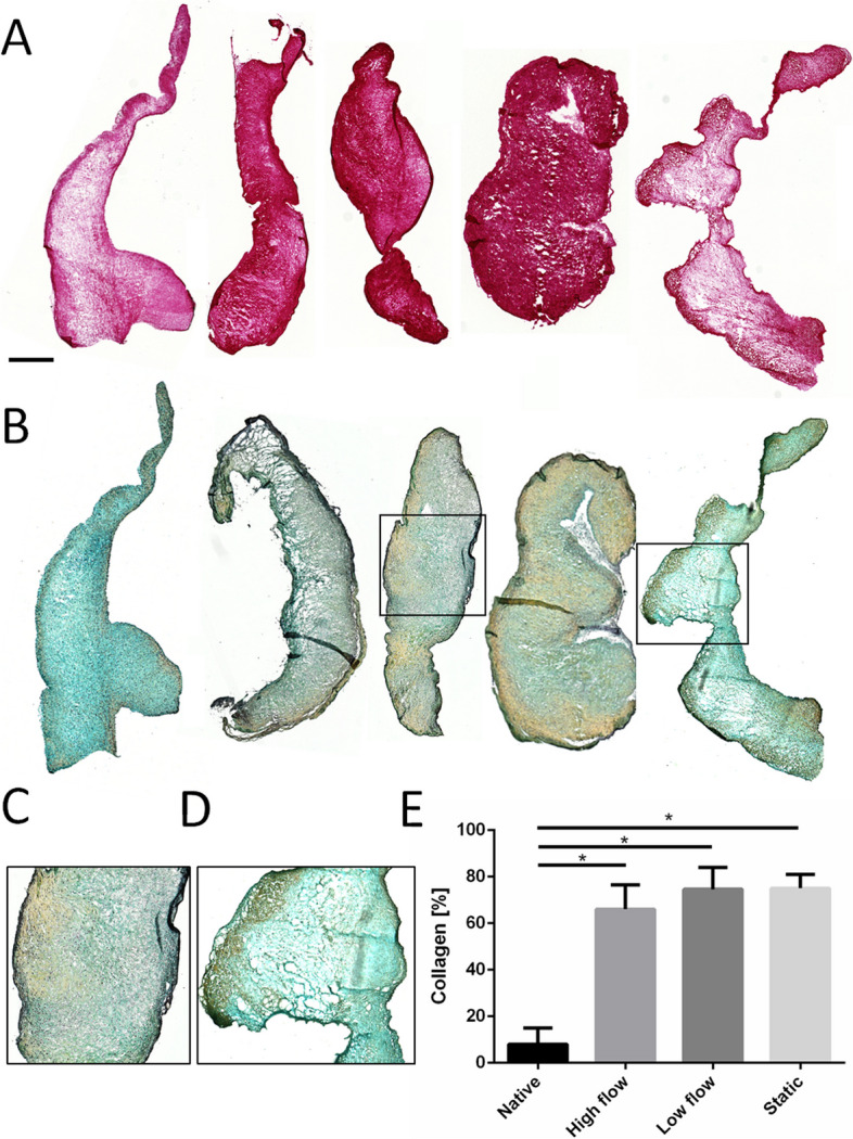 Challenges of aortic valve tissue culture - maintenance of viability and extracellular matrix in the pulsatile dynamic microphysiological system.