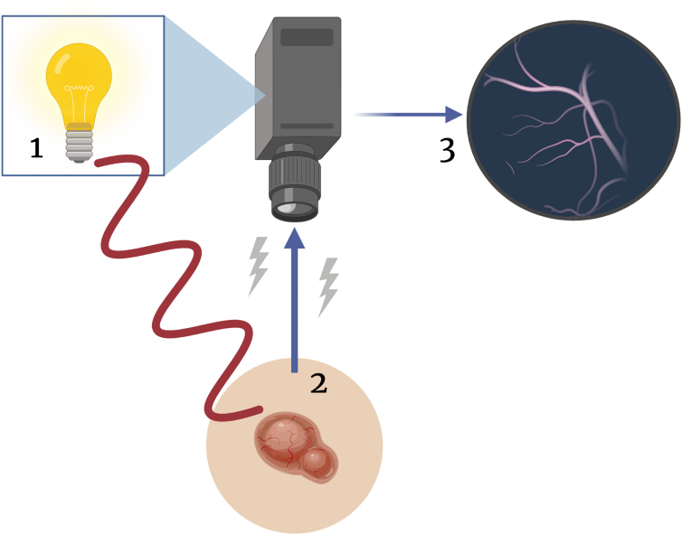 Applications of Laser Speckle Contrast Imaging Technology in Dermatology