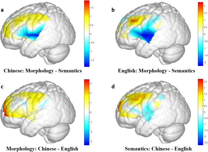 Shared and distinct neural correlates of first and second language morphological processing in bilingual brain.