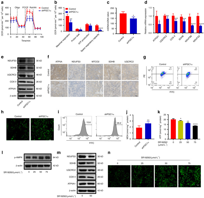 Knockdown of PGC1α suppresses dysplastic oral keratinocytes proliferation through reprogramming energy metabolism.