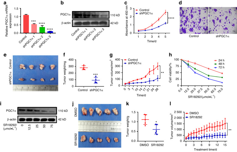 Knockdown of PGC1α suppresses dysplastic oral keratinocytes proliferation through reprogramming energy metabolism.