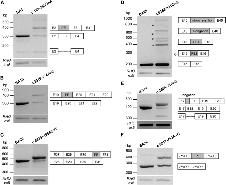 Targeted sequencing and in vitro splice assays shed light on ABCA4-associated retinopathies missing heritability.