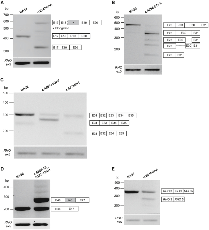 Targeted sequencing and in vitro splice assays shed light on ABCA4-associated retinopathies missing heritability.