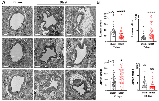 Low-intensity open-field blast exposure effects on neurovascular unit ultrastructure in mice.