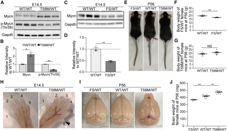 Gain-of-function MYCN causes a megalencephaly-polydactyly syndrome manifesting mirror phenotypes of Feingold syndrome.