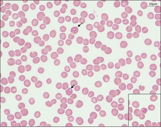 A case of equine piroplasmosis in the Tokyo 2020 Olympic Games.