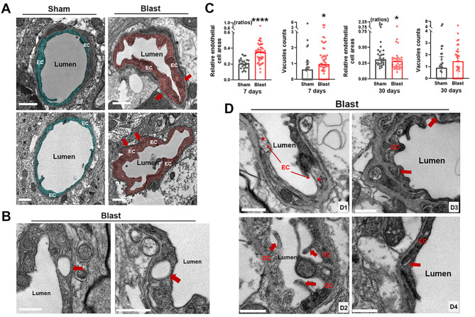 Low-intensity open-field blast exposure effects on neurovascular unit ultrastructure in mice.