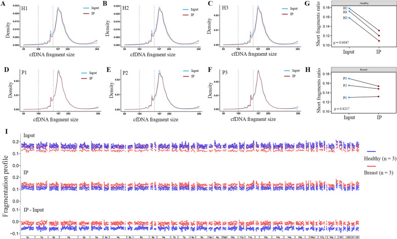 Altered cfDNA fragmentation profile in hypomethylated regions as diagnostic markers in breast cancer.