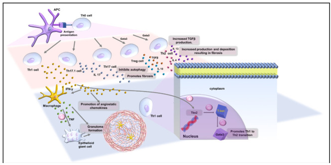 Pulmonary fibrosis in sarcoidosis.