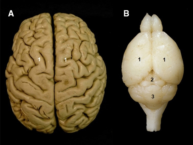 Bridging mouse and human anatomies; a knowledge-based approach to comparative anatomy for disease model phenotyping.