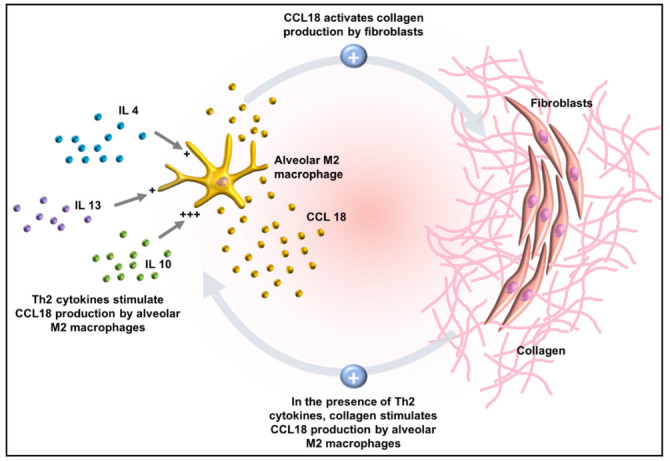 Pulmonary fibrosis in sarcoidosis.