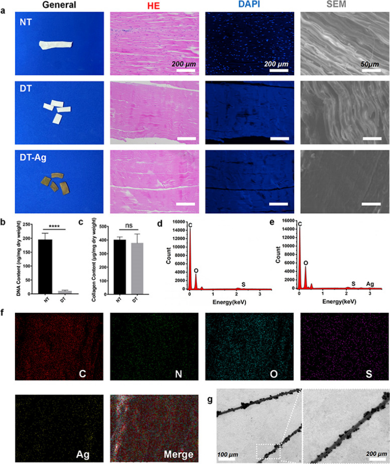 Silver nanoparticles-decorated extracellular matrix graft: fabrication and tendon reconstruction performance.