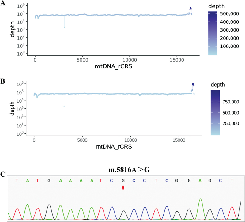 Possible Role of Mitochondrial Transfer RNA Gene 5816 A > G Genetic Polymorphism (m.5816A > G) in a 3-Year-Old Child with Dystonia: Report of a Case.