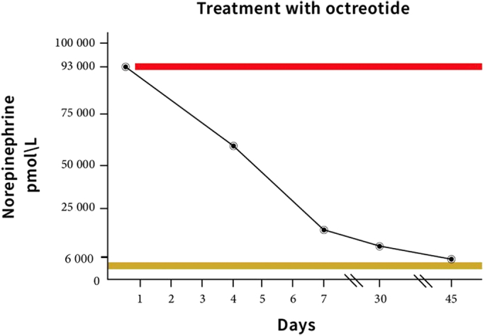 Hypertensive Crisis in a Patient With a Functioning Mesenteric Paraganglioma: Dramatic Response to Octreotide Treatment