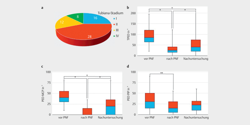 [Medium-term Results after percutaneous Needle Fasciotomy in Dupuytren's Disease].