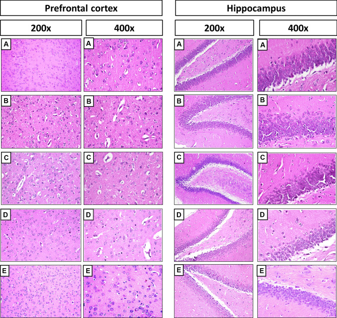 L-carnitine Modulates Cognitive Impairment Induced by Doxorubicin and Cyclophosphamide in Rats; Insights to Oxidative Stress, Inflammation, Synaptic Plasticity, Liver/brain, and Kidney/brain Axes.