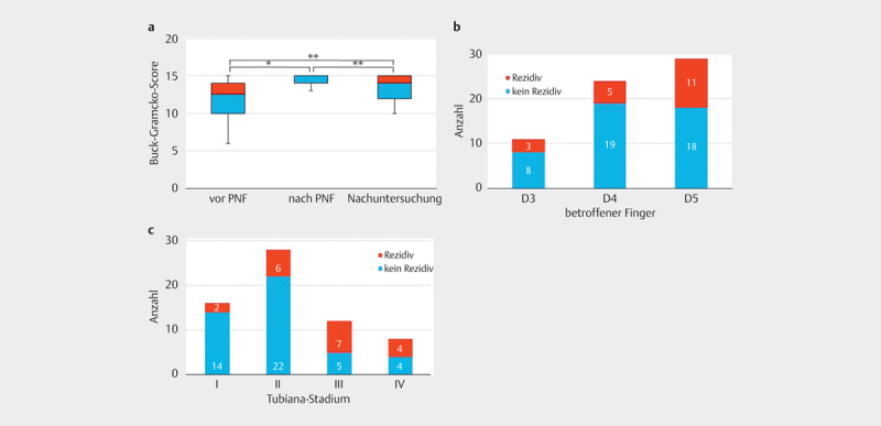 [Medium-term Results after percutaneous Needle Fasciotomy in Dupuytren's Disease].