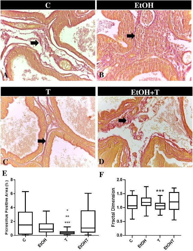 Fractal analysis is a useful tool for evaluating prostate tissue remodeling caused by ethanol consumption and androgen therapy.