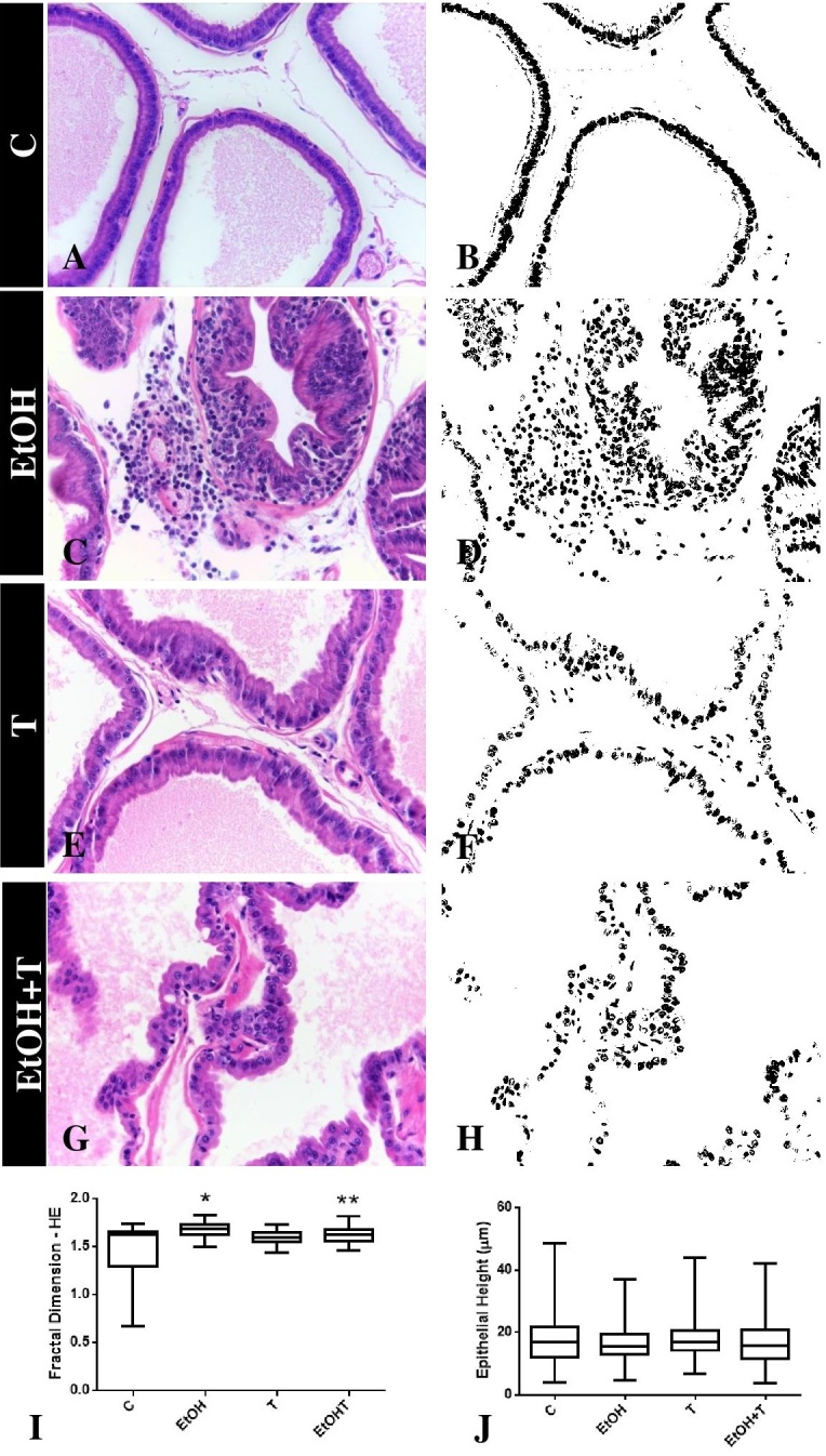 Fractal analysis is a useful tool for evaluating prostate tissue remodeling caused by ethanol consumption and androgen therapy.