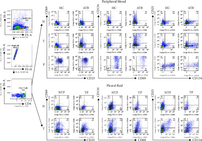 Diagnostic Value of CD25, CD69, and CD134 on Tuberculosis-Specific Antigen-Stimulated CD4+ T Cells for Tuberculous Pleurisy.