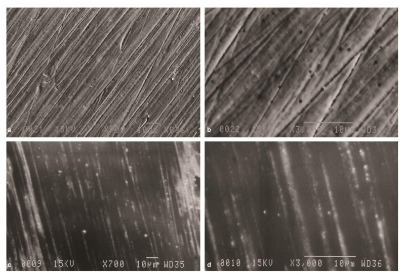 Effect of Low-Temperature Degradation, Ph-Cycling and Simulated Tooth Brushing on Surface Roughness, Topography, and Polish Retention of Yttrium-Stabilized Tetragonal Zirconia.