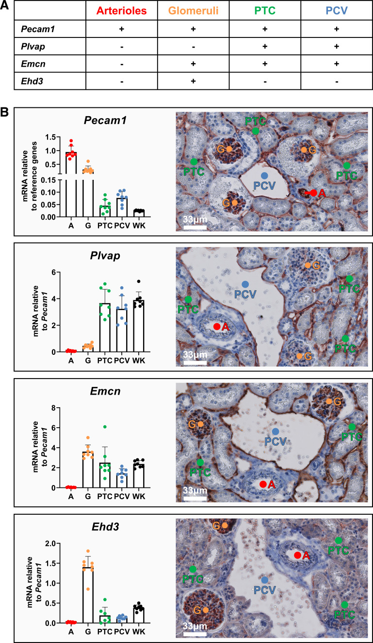 Unique miRNome and transcriptome profiles underlie microvascular heterogeneity in mouse kidney.