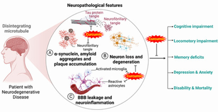 Curcumin, inflammation, and neurological disorders: How are they linked?