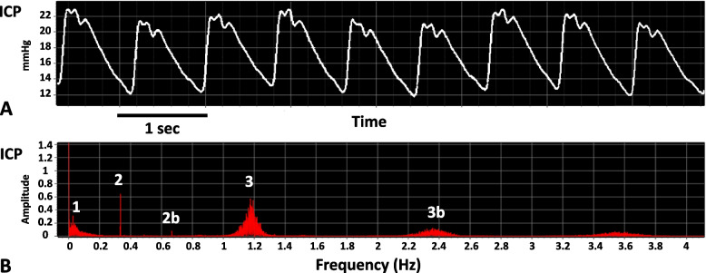 Intracranial pressure for clinicians: it is not just a number.