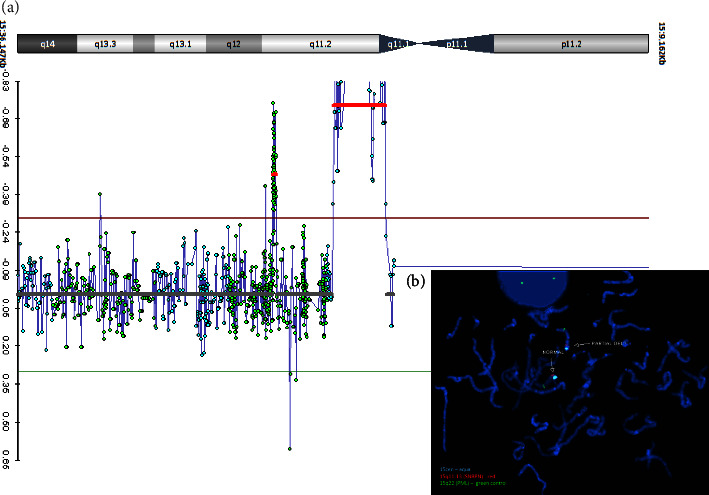 An Atypical 15q11.2 Microdeletion Not Involving <i>SNORD116</i> Resulting in Prader-Willi Syndrome.