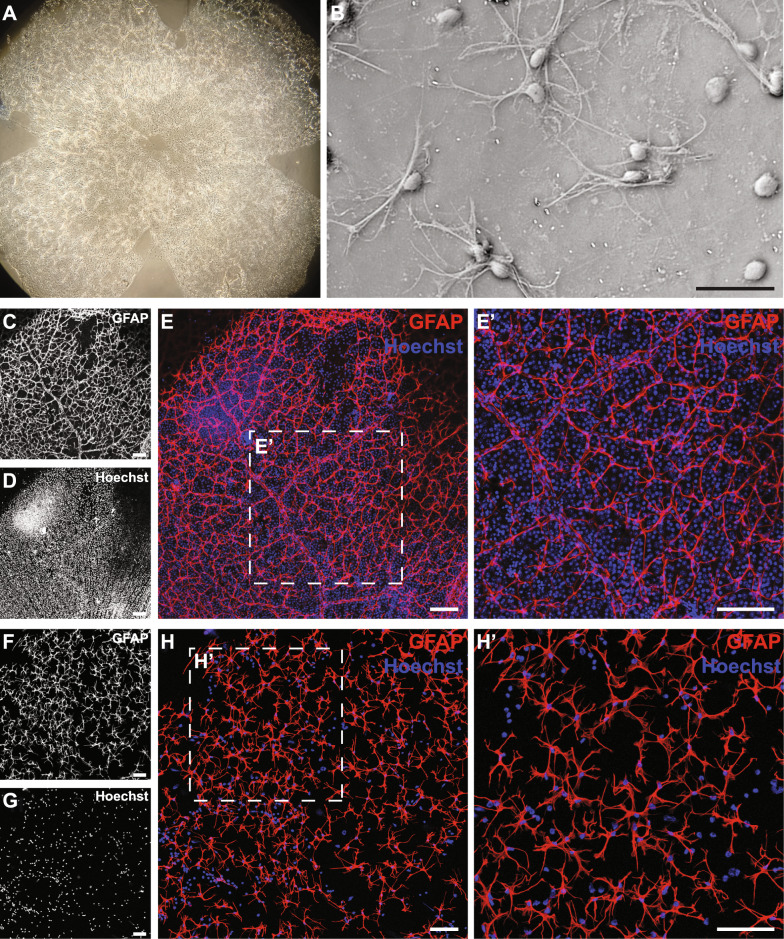 Rapid isolation of intact retinal astrocytes: a novel approach.