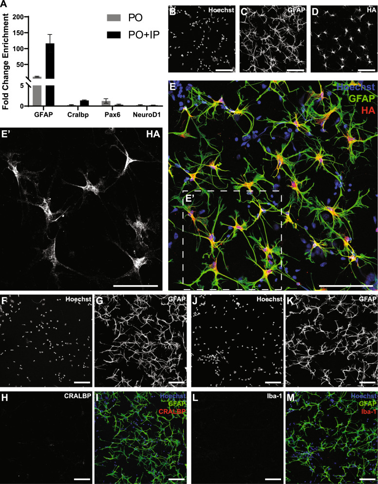 Rapid isolation of intact retinal astrocytes: a novel approach.