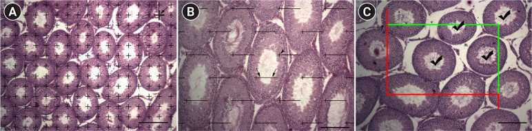 Stereological study of testes following experimentally-induced unilateral cryptorchidism in rats.