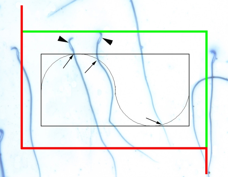 Stereological study of testes following experimentally-induced unilateral cryptorchidism in rats.